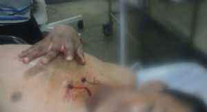 Homem leva tiro no abdmen durante  discusso em stio em Porto Esperidio
